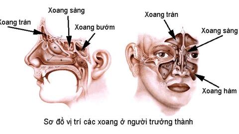 Viêm xoang sàng sau có nguy hiểm không?