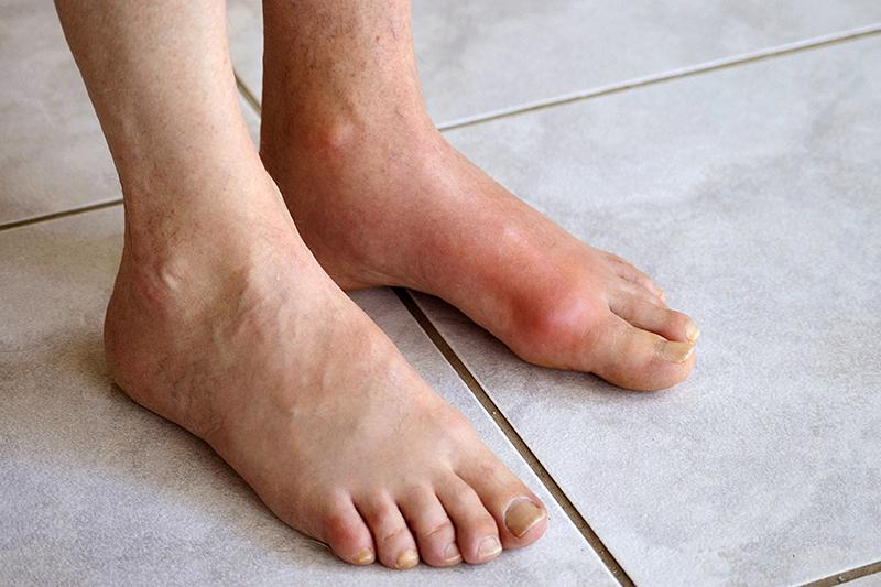 bệnh lý cơ xương khớp